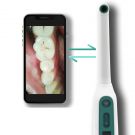 Oravall Live Dental Camera tartar check 360 degree 